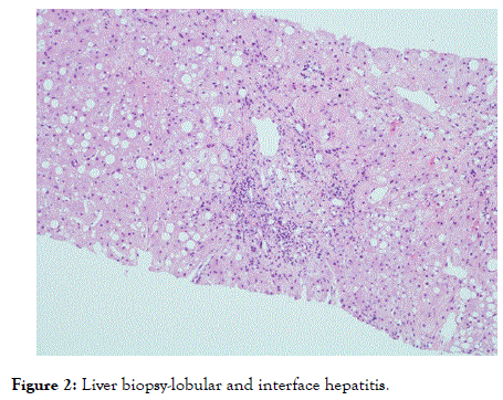 Rheumatology-biopsy-lobular