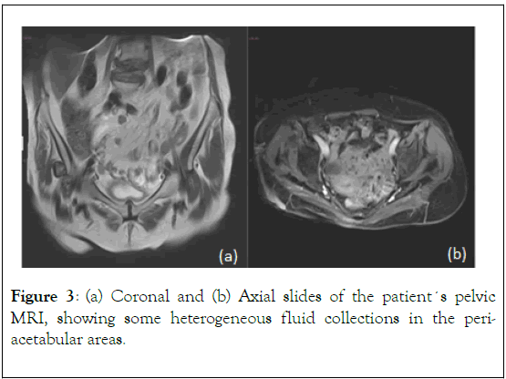 Rheumatology-heterogeneous