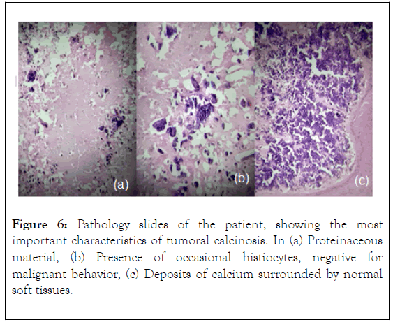 Rheumatology-malignant