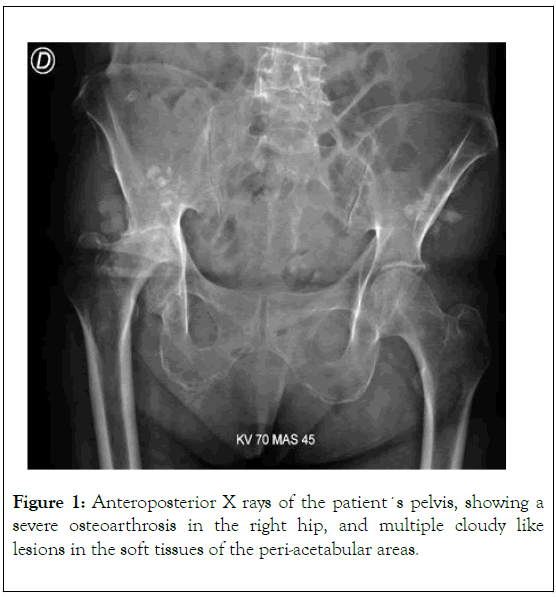 Rheumatology-osteoarthrosis