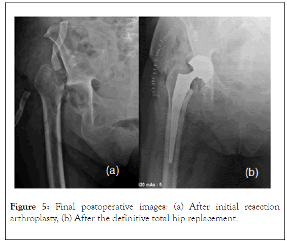 Rheumatology-postoperative