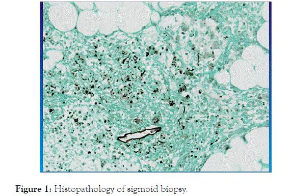 Rheumatology-sigmoid