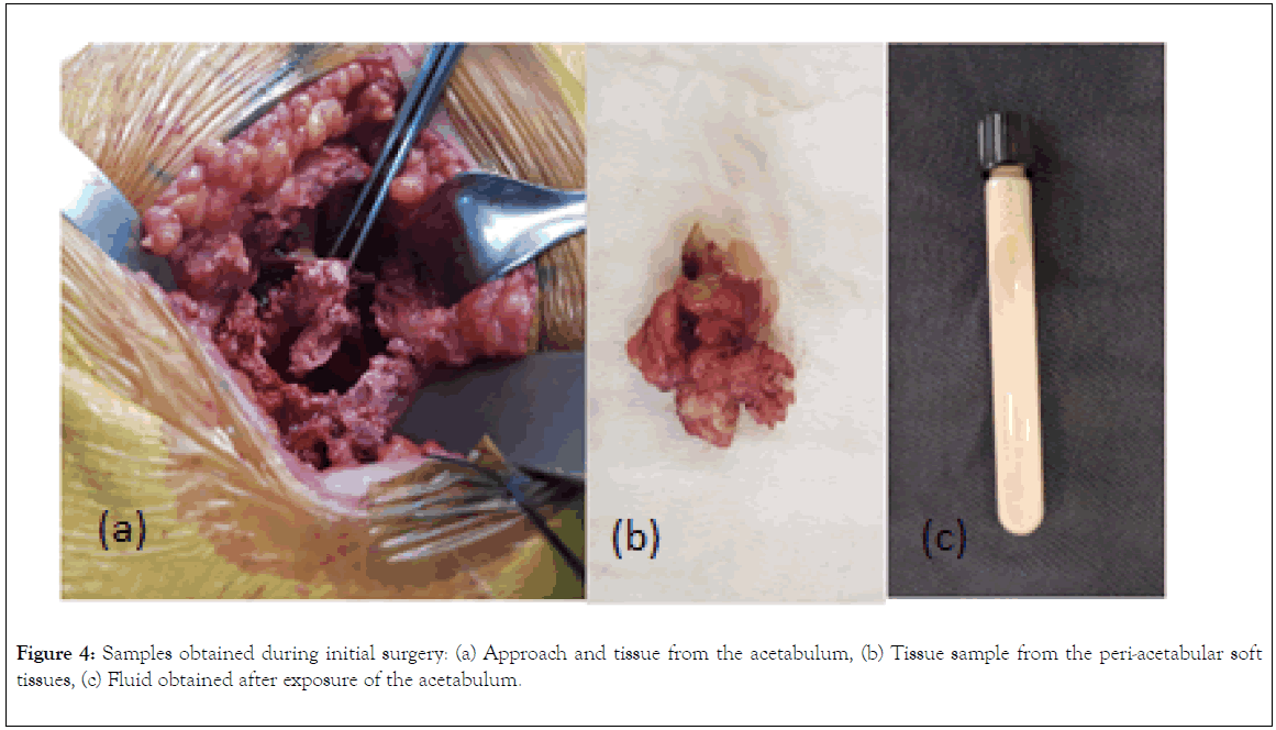 Rheumatology-surgery