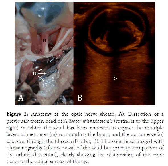 anatomy-physiology-nerve