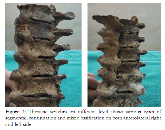 anatomy-physiology-vertebra