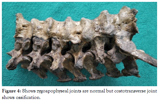 anatomy-physiology-zygoapophyseal