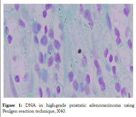 andrology-Feulgen-reaction