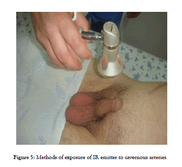 andrology-cavernous-arteries