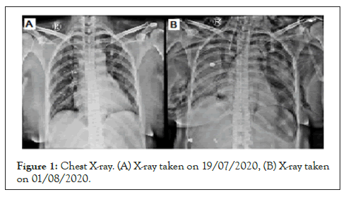 anesthesia-clinical-chest