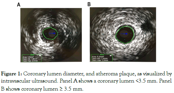 angiology-coronary-lumen-diameter