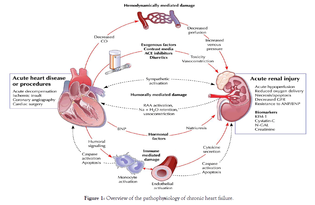 angiology-pathophysiology-chronic