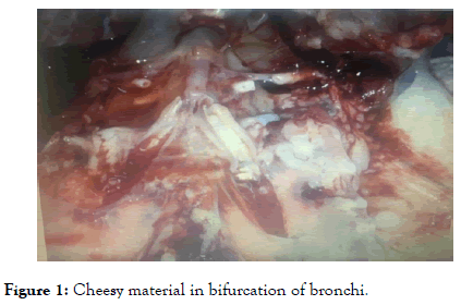 antivirals-antiretrovirals-Cheesy-material