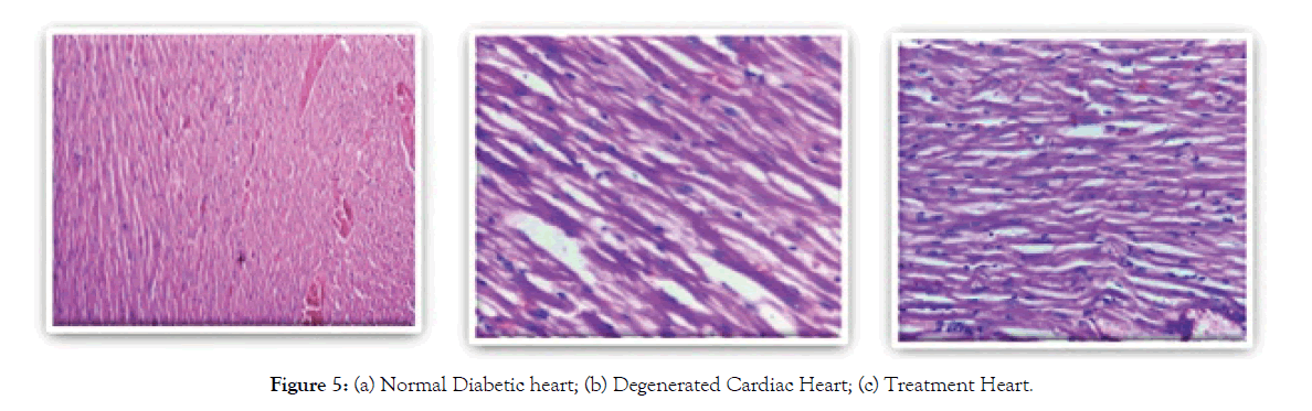 biochemistry-pharmacology-Diabetic-heart