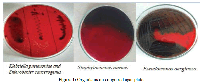 ur Tips Underholde Inhibition of Bacterial Biofilms by Streptomyces Derived Crude Extract