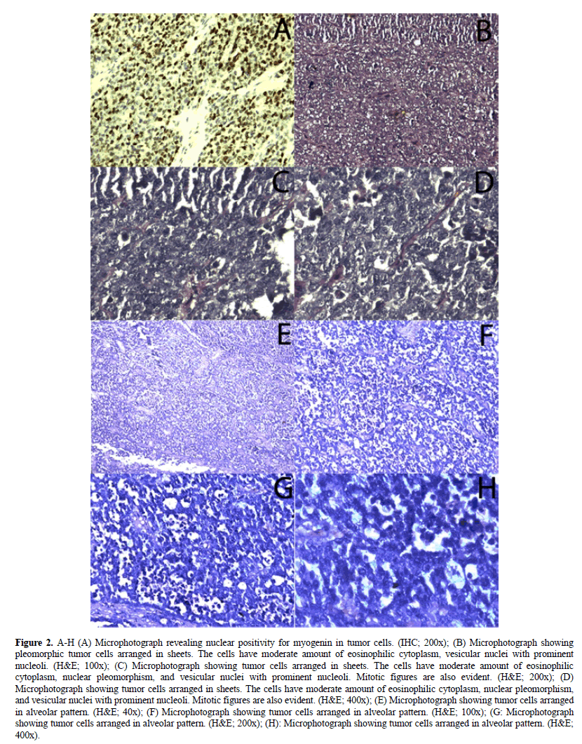 biology-todays-world-myogenin