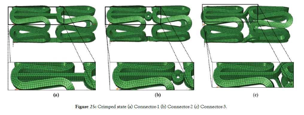 biomedical-engineering-medical-devices-Crimped-state