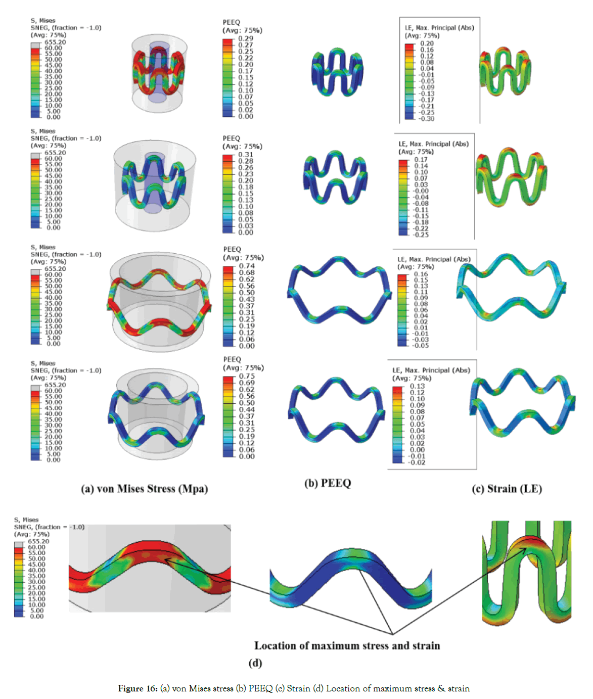 biomedical-engineering-medical-devices-Mises-stress