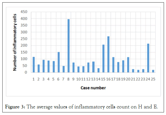 cancer-research-inflammatory