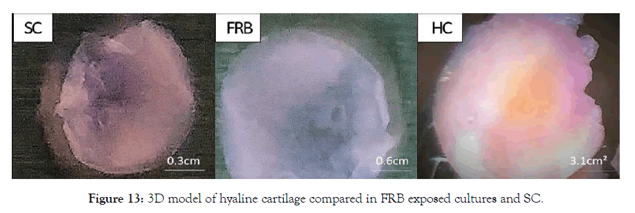 cell-science-therapy-hyaline-cartilage