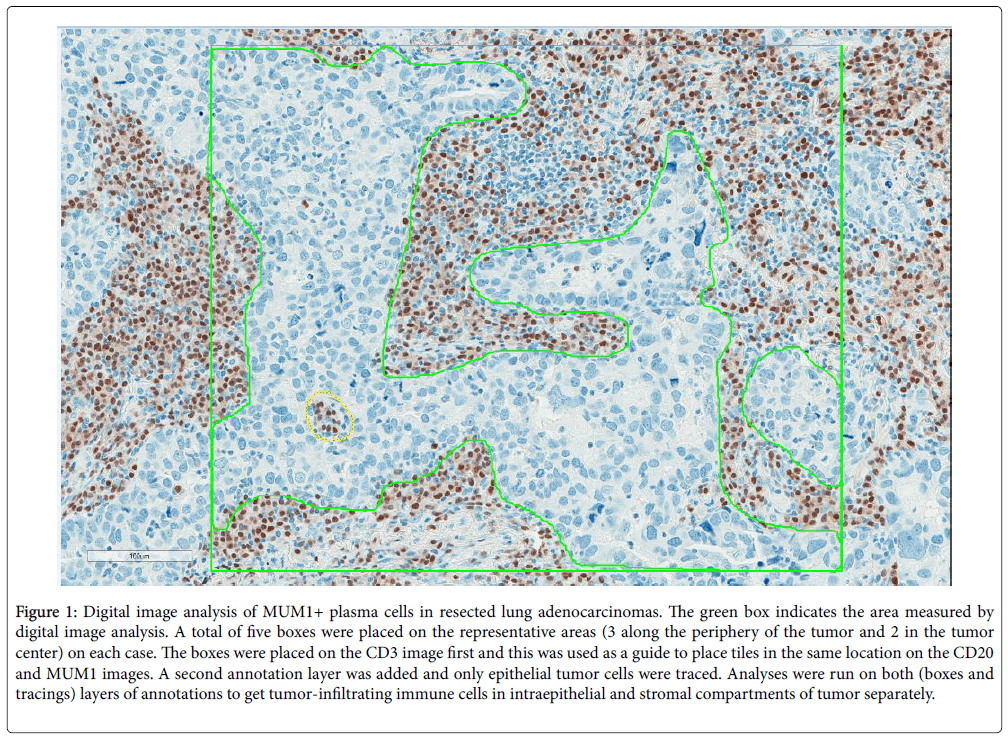 clinical-cellular-immunology-adenocarcinomas