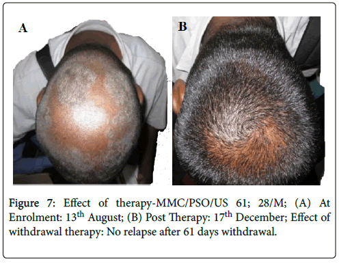 clinical-dermatology-Post-therapy