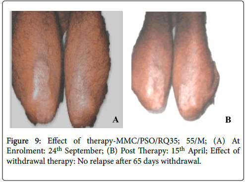 clinical-dermatology-hyperpigmentation