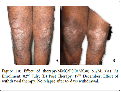 clinical-dermatology-hyperpigmentation