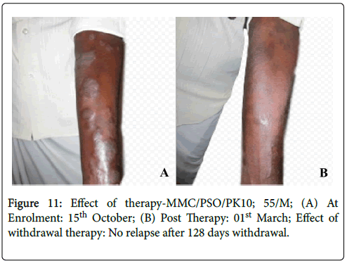 clinical-dermatology-hyperpigmentation