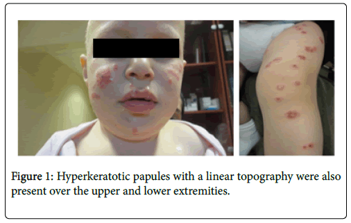 clinical-dermatology-linear-topography