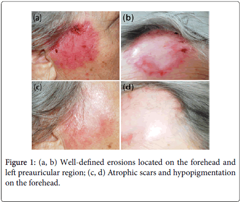 clinical-dermatology-preauricular-region