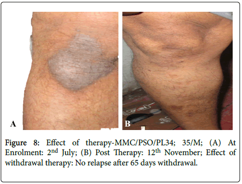 clinical-dermatology-psoriatic-symptom