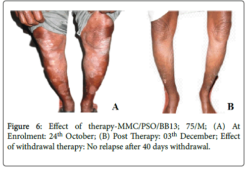 clinical-dermatology-withdrawal-therapy
