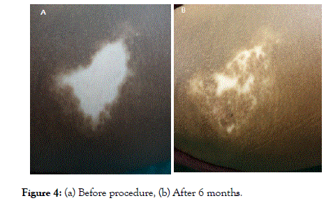 clinical-experimental-dermatology-Before-procedure