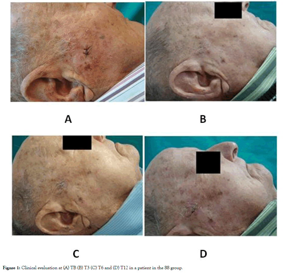 clinical-experimental-dermatology-Clinical-evaluation