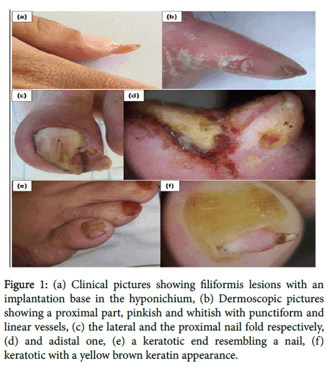 clinical-experimental-dermatology-Clinical-pictures
