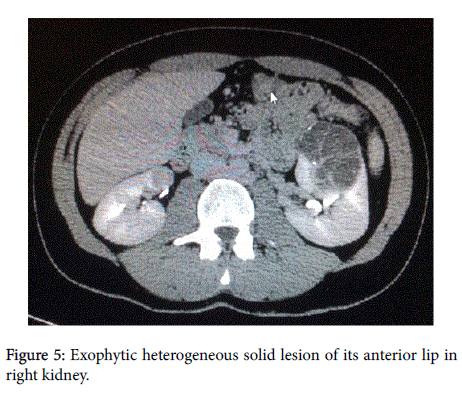 clinical-experimental-dermatology-Exophytic-heterogeneous