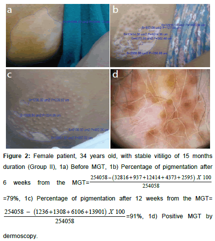 clinical-experimental-dermatology-Female-patient