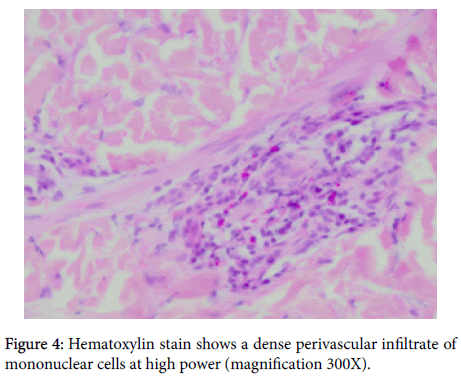 clinical-experimental-dermatology-Hematoxylin