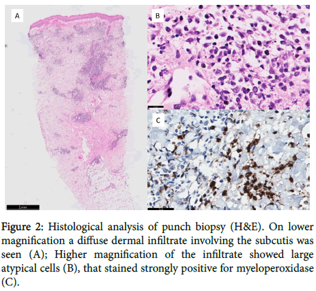 clinical-experimental-dermatology-Histological