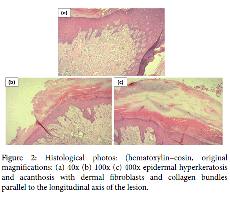 clinical-experimental-dermatology-Histological-photos