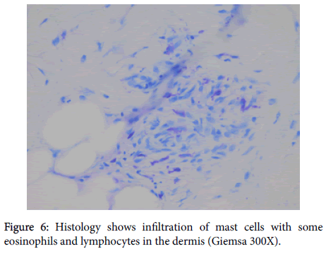 clinical-experimental-dermatology-Histology