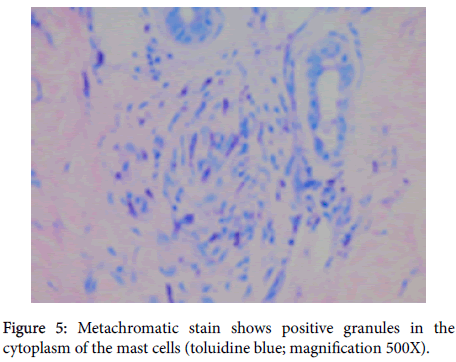 clinical-experimental-dermatology-Metachromatic