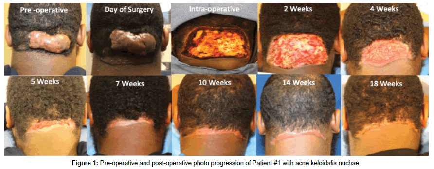 clinical-experimental-dermatology-Pre-operative