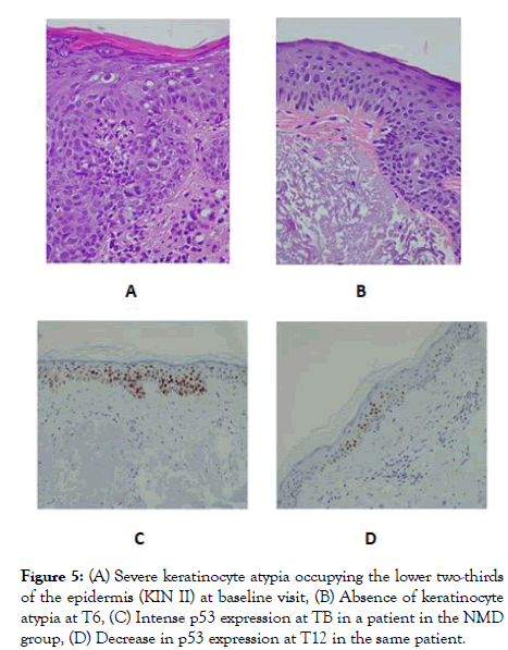 clinical-experimental-dermatology-Severe-keratinocyte