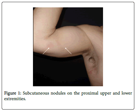 clinical-experimental-dermatology-Subcutaneous