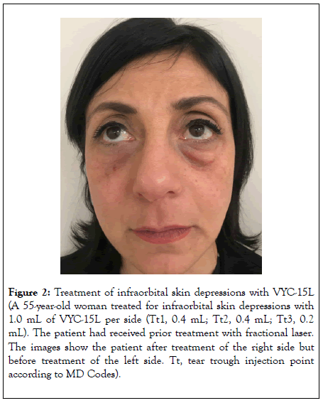 clinical-experimental-dermatology-after