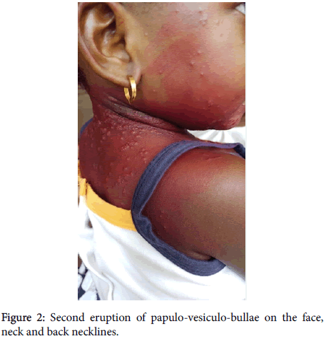 clinical-experimental-dermatology-back-necklines