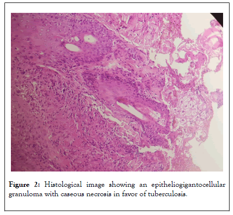 clinical-experimental-dermatology-caseous