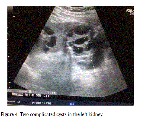 clinical-experimental-dermatology-complicated-cysts