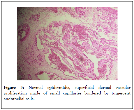 clinical-experimental-dermatology-epidermidis